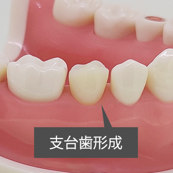 統合型実習用模型 [D16HD-X.1602]｜株式会社ニッシン｜歯科模型・歯科